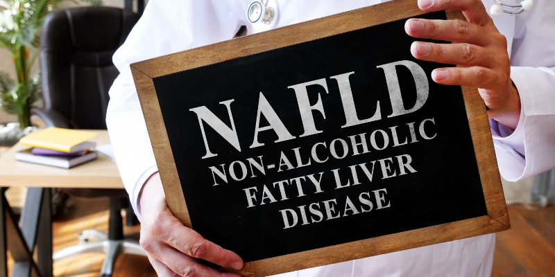 NAFLD: Non-alcoholic fatty liver disease