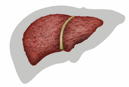 Liver disease