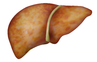 Liver disease